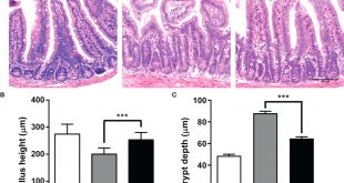 Vpn Services In Glenn Ca Dans Frontiers (-)-epigallocatechin-3-gallate (egcg) Modulates the ...