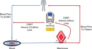 Cheap Vpn In Keith Ne Dans How to Prescribe and Troubleshoot Continuous Renal Replacement ...