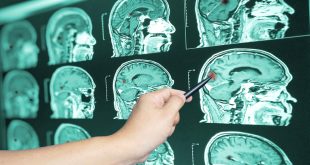 Car Accident Lawyer In Lawrence Ky Dans Kettering Traumatic Brain Injury Lawyer