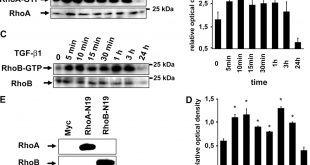 Cheap Vpn In Saline Il Dans Lim-kinase 2 and Cofilin Phosphorylation Mediate Actin ...