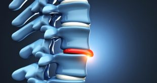 Decatur In Car Accident Lawyer Dans What is the Average Settlement for A Herniated Disc Car Accident