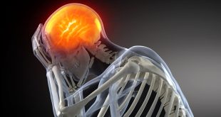 Wayne Oh Car Accident Lawyer Dans Murray Traumatic Brain Injury Lawyer