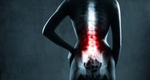 What Does A Car Accident Lawyer Do Dans Severe Back Pain after A Car Accident