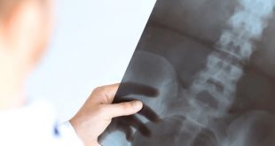 Questions for Personal Injury Lawyer Dans Suffering From A Back Injury Contact A Texas Spinal Cord Injury Lawyer