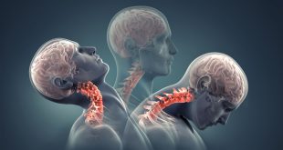 Personil Injury Lawyer In Perry Mo Dans Neck Injury Lawyer Back Injury Lawyer Personal Injury Lawyer